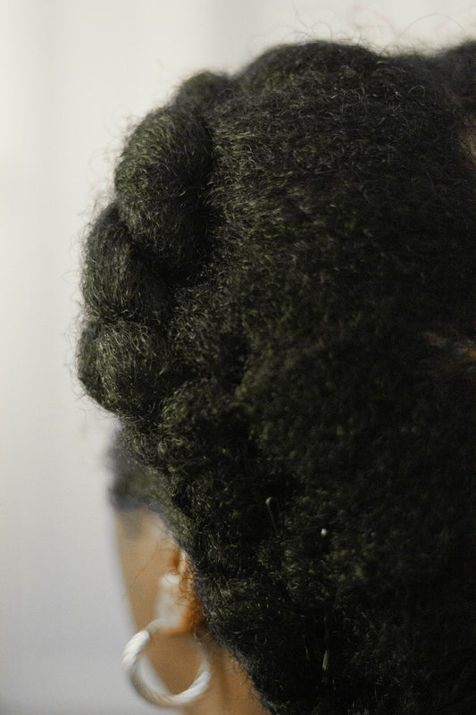 Let's Discuss Hair Loss!